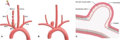 An Improved Surgical Technique to Increase Neck Width of Elastase-Induced Aneurysm Model in Rabbits: A Prospective Study